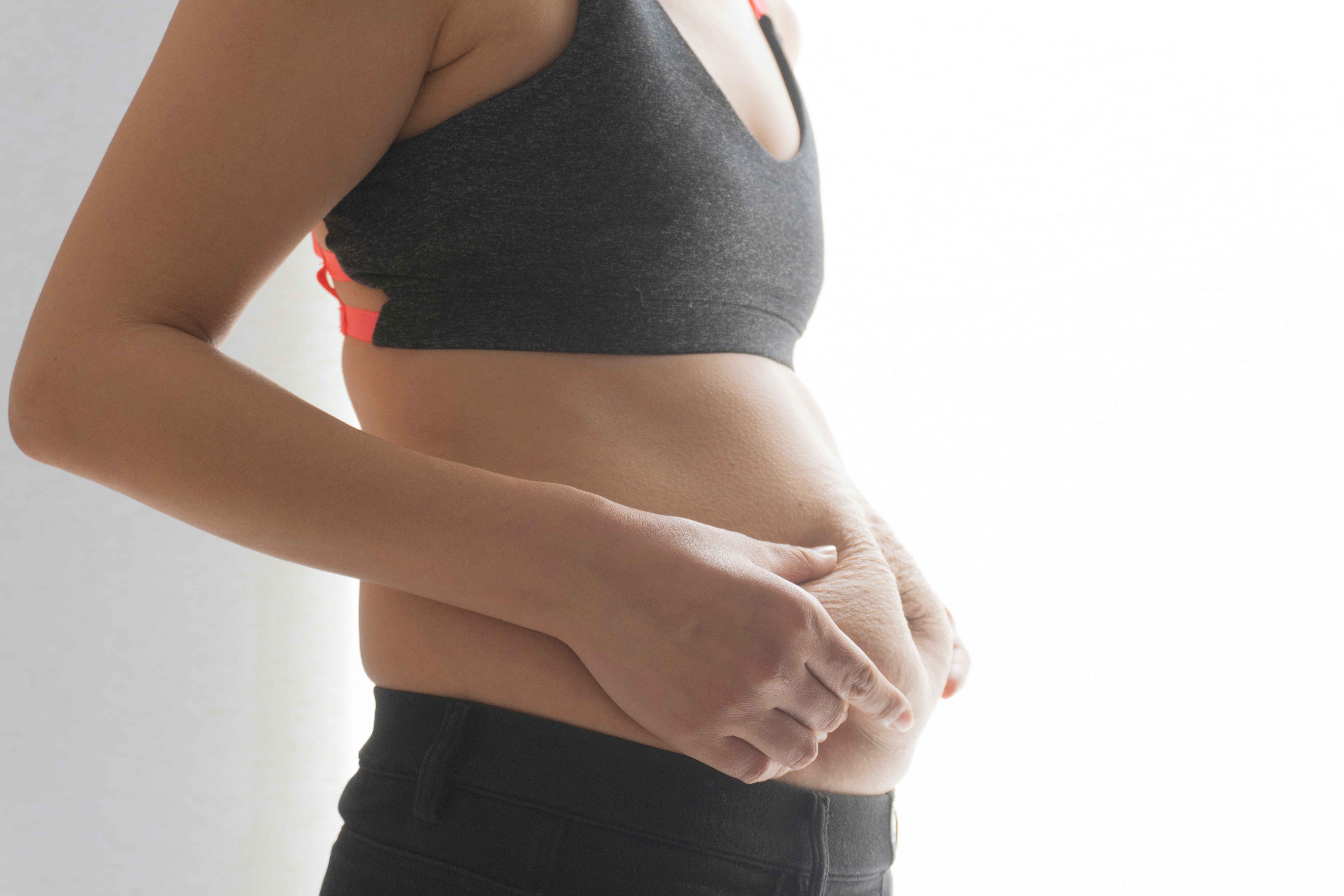 Eine Frau in Sportkleidung hält ihre Bauchhaut, um Dehnungsstreifen nach der Schwangerschaft zu zeigen.
